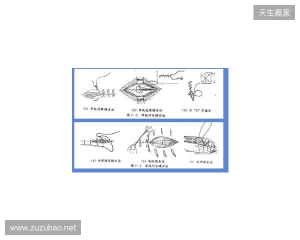 广州豹官方:杨浩眉弓伤口缝合30余针,预计5-7天后拆线 广州豹官方:杨浩眉弓伤口缝合30余针,预计5-7天后拆线